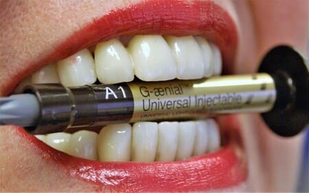 Estetska stomatologija Crnojević Dental Studio